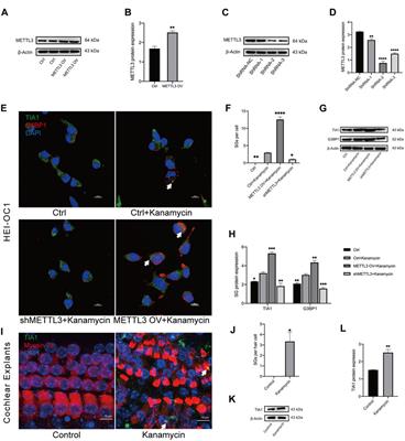 Investigation of METTL3 as an inhibitor of kanamycin-induced ototoxicity via stress granule formation